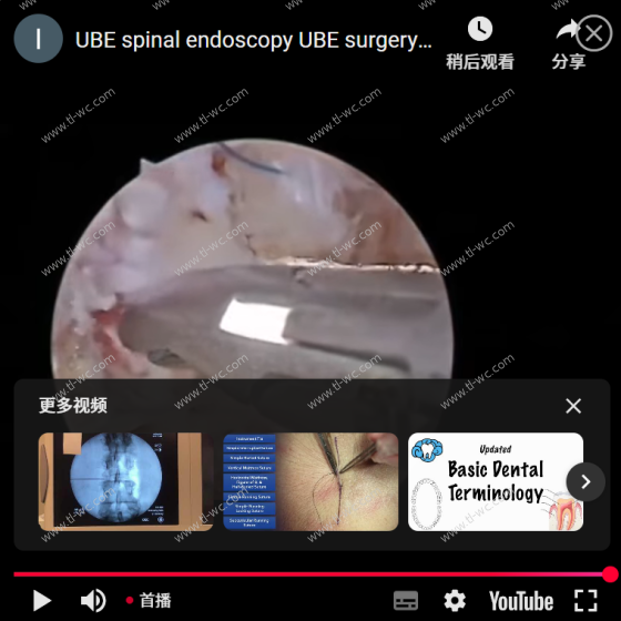 UBE spinal endoscopy UBE surgery annulus fibrosus suture video